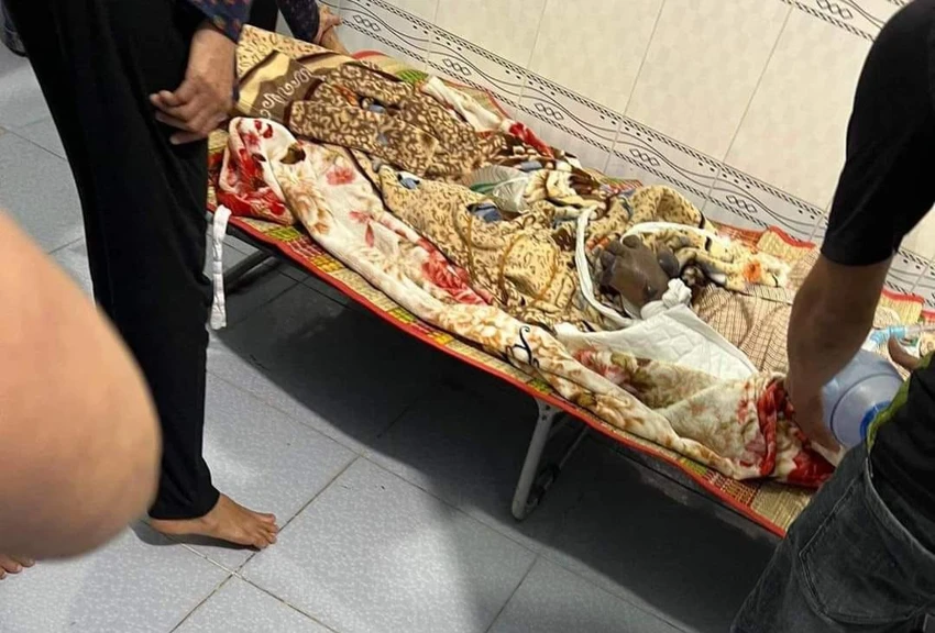 Chỉ một lúc sau khi bị rắn cắn, bàn tay ông C đã tím tái. Ảnh VT Chỉ một lúc sau khi bị rắn cắn, bàn tay ông C đã tím tái. Ảnh VT