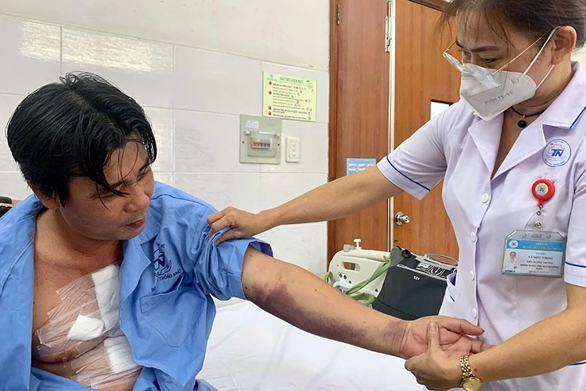 Những vết thương ở ngực và tay của tài xế xe ôm sau khi vật lộn với tên cướp. Ảnh: HOÀNG LAN Những vết thương ở ngực và tay của tài xế xe ôm sau khi vật lộn với tên cướp. Ảnh: HOÀNG LAN