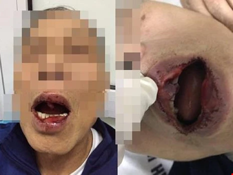 Cán bộ sở Ngoại vụ đánh tiến sĩ 76 tuổi sau va chạm - ảnh 1