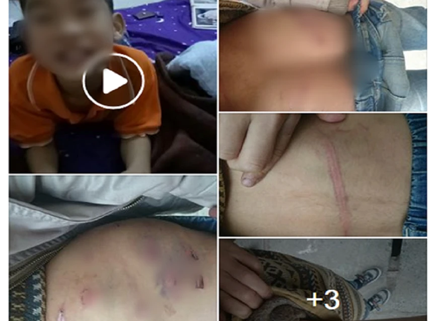 Bạo hành dã man con trai 9 tuổi vì... cháu hư ảnh 2