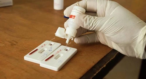 Tìm ra loại thuốc có thể 'diệt tận gốc' HIV - ảnh 1