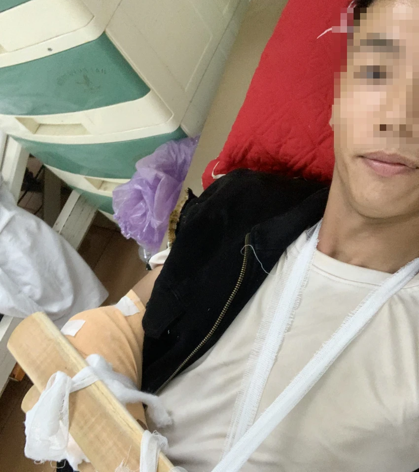 Anh D được xác định tỉ lệ thương tích là 11%. Ảnh: NVCC Anh D được xác định tỉ lệ thương tích là 11%. Ảnh: NVCC
