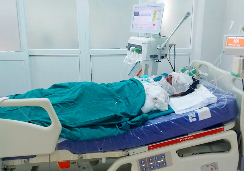 Ba người nhập viện do tự ý chế tạo pháo dẫn đến vụ nổ gây thương tích ở Kon Tum
