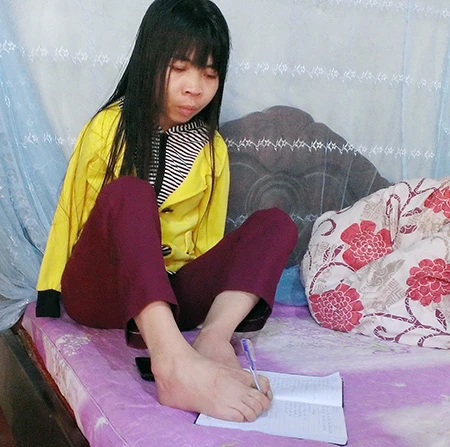 Người phụ nữ bị mang đi giấu vì … dị dạng ảnh 1