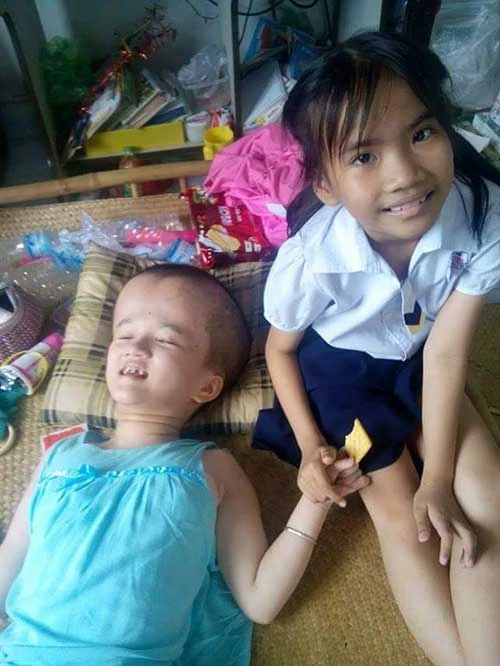 Em ung thư nhường chị não úng thủy chữa bệnh ảnh 2 Em ung thư nhường chị não úng thủy chữa bệnh ảnh 2