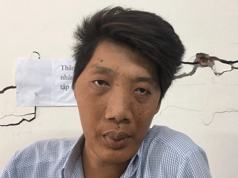 Người ‘khổng lồ’ gây choáng cả bệnh viện ảnh 2 Người ‘khổng lồ’ gây choáng cả bệnh viện ảnh 2