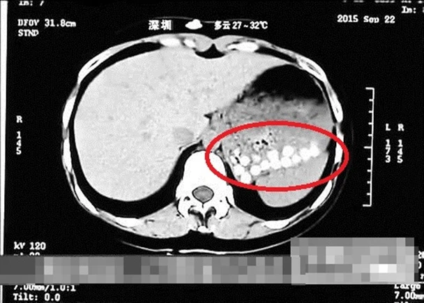 Kinh hoàng trà sữa trân châu Trung Quốc làm từ lốp xe và đế giày ảnh 2 Kinh hoàng trà sữa trân châu Trung Quốc làm từ lốp xe và đế giày ảnh 2