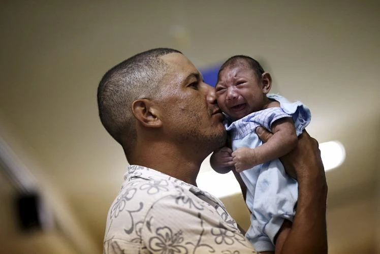 Đại dịch Zika sẽ chấm dứt trong ba năm nữa ảnh 1 Người cha ôm đứa con bị mắc tật đầu nhỏ vì tác động của virus Zika từ khi còn trong bụng mẹ.