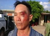 Một người đang 'tố' cán bộ nhận hối lộ bị đánh nhập viện
