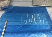 Sán heo dài 2m sống trong ruột người đàn ông 10 năm