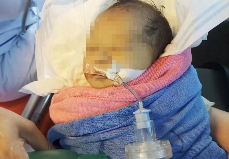 Sức khoẻ cháu bé đang chuyển biến xấu. Ảnh: TN Sức khoẻ cháu bé đang chuyển biến xấu. Ảnh: TN