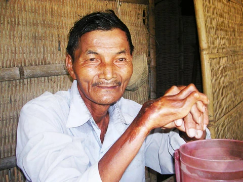 Hy hữu, lão nhân 45 năm chưa hề chợp mắt ảnh 1 Hy hữu, lão nhân 45 năm chưa hề chợp mắt ảnh 1