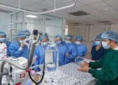 Diệu Nhi trong cặp bé song sinh dính nhau đã cai máy thở