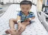 Cậu bé 4 tuổi bị rắn cắn khi đang thả diều