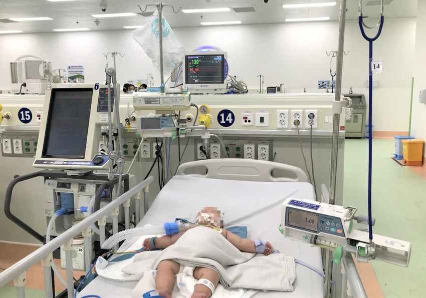Bệnh nhi bị sốc sốt xuất huyết nặng phải thở máy đang được hồi sức tích cực. Ảnh: BVCC Bệnh nhi bị sốc sốt xuất huyết nặng phải thở máy đang được hồi sức tích cực. Ảnh: BVCC