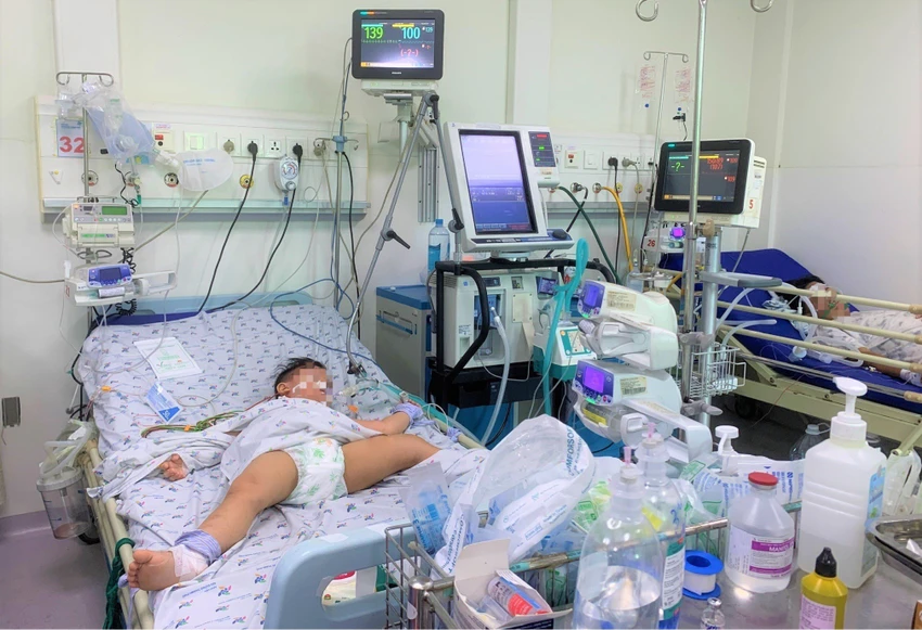 Một ca tay chân miệng nặng đang thở máy tại BV Nhi đồng TP. Ảnh: THẢO PHƯƠNG