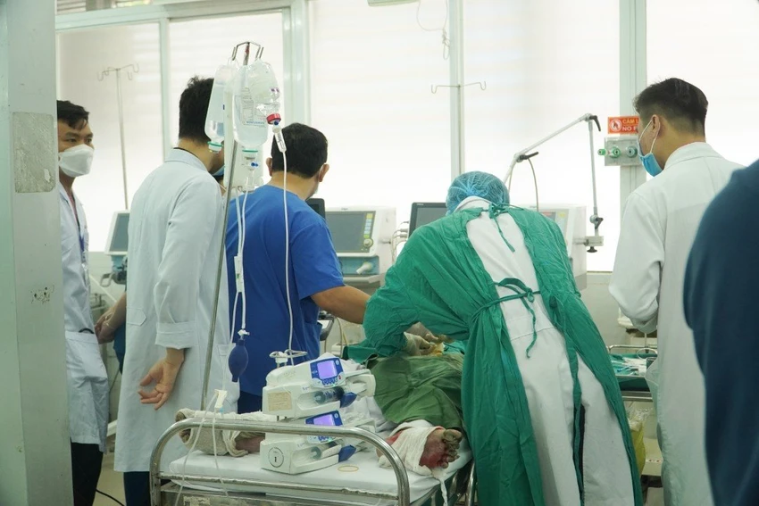 Một bệnh nhân trong vụ cháy đang điều trị tại BV Chợ Rẫy. Ảnh: BVCC Một bệnh nhân trong vụ cháy đang điều trị tại BV Chợ Rẫy. Ảnh: BVCC