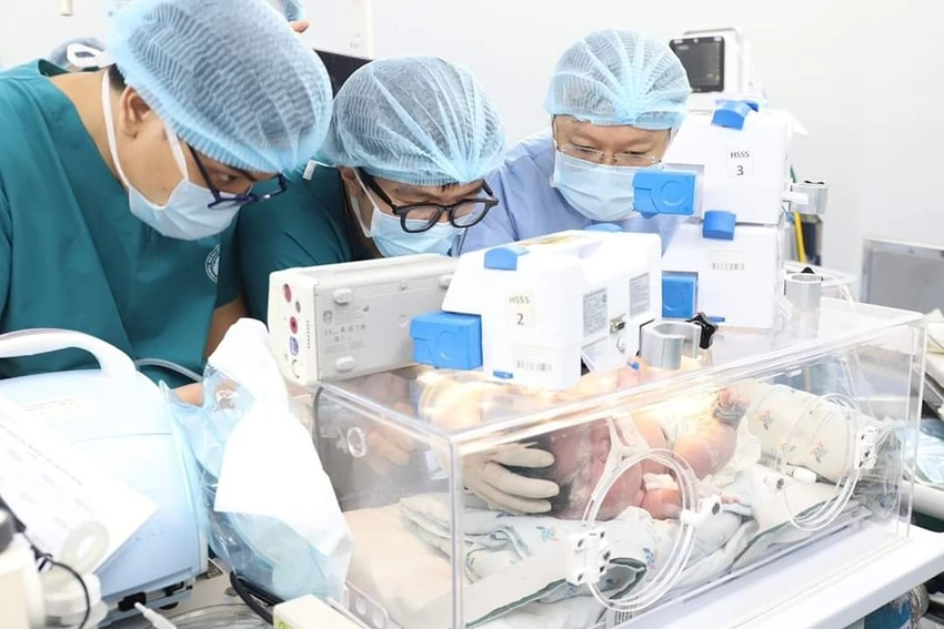 Hai bệnh viện sản và nhi phối hợp cứu sống trẻ sơ sinh mắc khối bướu cổ khổng lồ. Ảnh: BVCC Hai bệnh viện sản và nhi phối hợp cứu sống trẻ sơ sinh mắc khối bướu cổ khổng lồ. Ảnh: BVCC