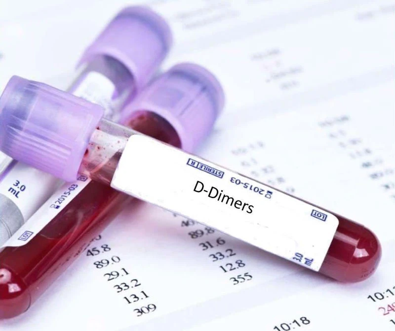 Xét nghiệm D-dimer - 1