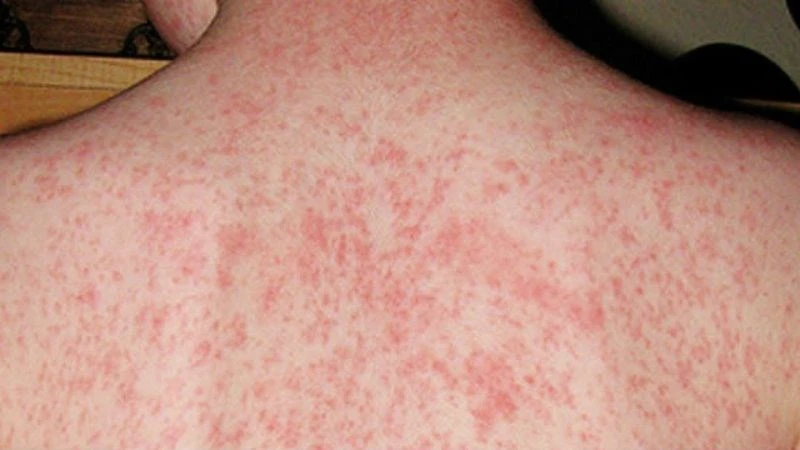 soi-o-tp.hcm1.jpg