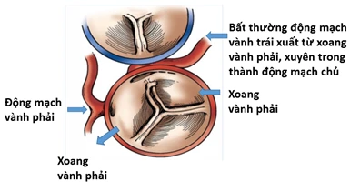 di-tat-tim-bam-sinh.png