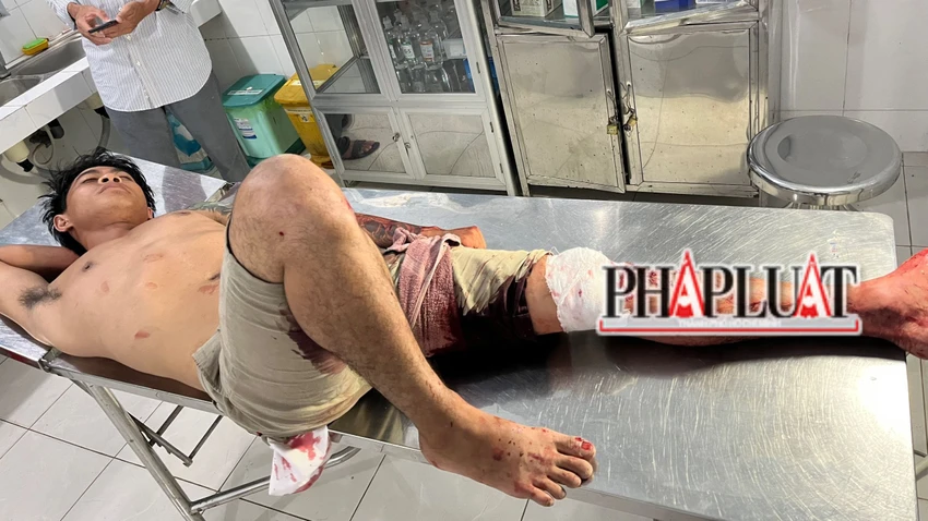 Anh Giang bị chém nhiều nhát phải nhập viện cấp cứu. Ảnh: VT Anh Giang bị chém nhiều nhát phải nhập viện cấp cứu