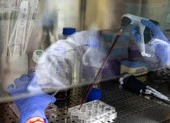 Nga thử nghiệm vaccine COVID-19 Sputnik V trên người cao tuổi