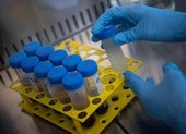 Nan giải nỗ lực tìm nguồn gốc virus gây dịch COVID-19
