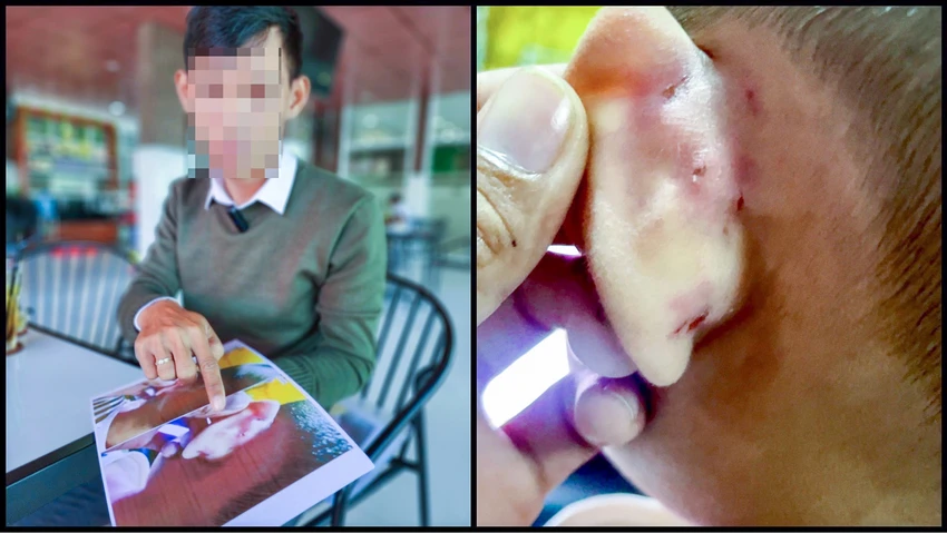 Bức xúc vì cháu M. bị bạo hành, gia đình đã tố cáo đến cơ quan công an. Ảnh: TUẤN THY Bức xúc vì cháu M. bị bạo hành, gia đình đã tố cáo đến cơ quan công an. Ảnh: TUẤN THY