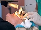 Có nên phẫu thuật chữa cận thị?