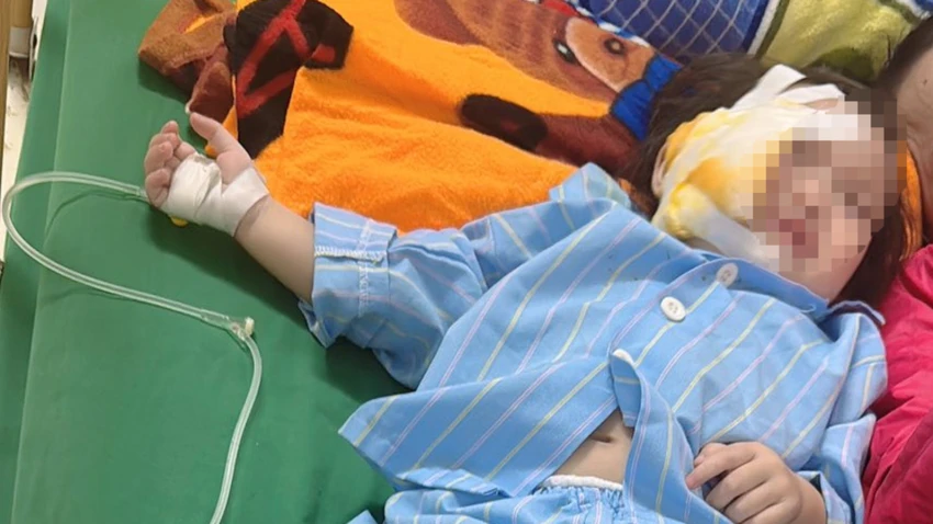 Cháu H.N.K.V bị thương phải nằm viện cấp cứu, điều trị. hoc-sinh-bi-thuong.jpg