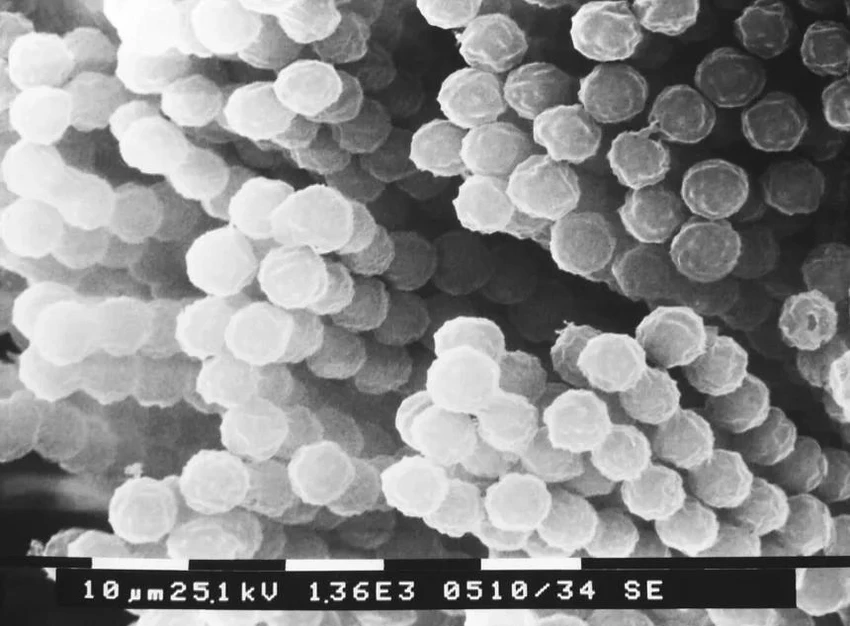 Bào tử nấm Aspergillus dưới kính hiển vi.jpg