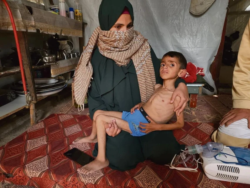 Hậu quả kéo dài nhiều thế hệ do nạn đói ở Gaza