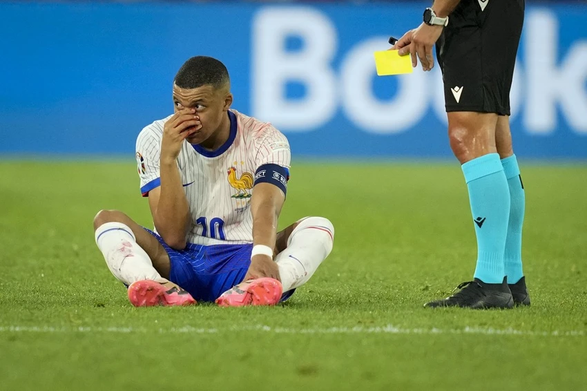 hlv-deschamps-cai-mui-cua-mbappe-khong-on-chut-nao (1).jpeg