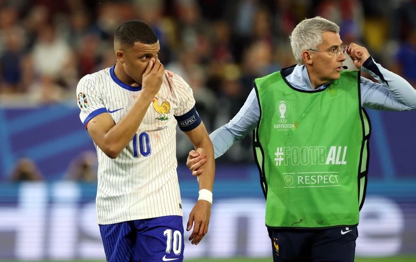 Mbappe bị gãy mũi