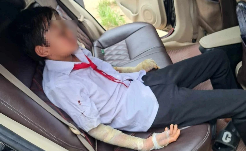 Học sinh trong vụ nổ bóng bay được đưa đi cấp cứu. Ảnh: NDCC Học sinh trong vụ nổ bóng bay được đưa đi cấp cứu. Ảnh: NDCC
