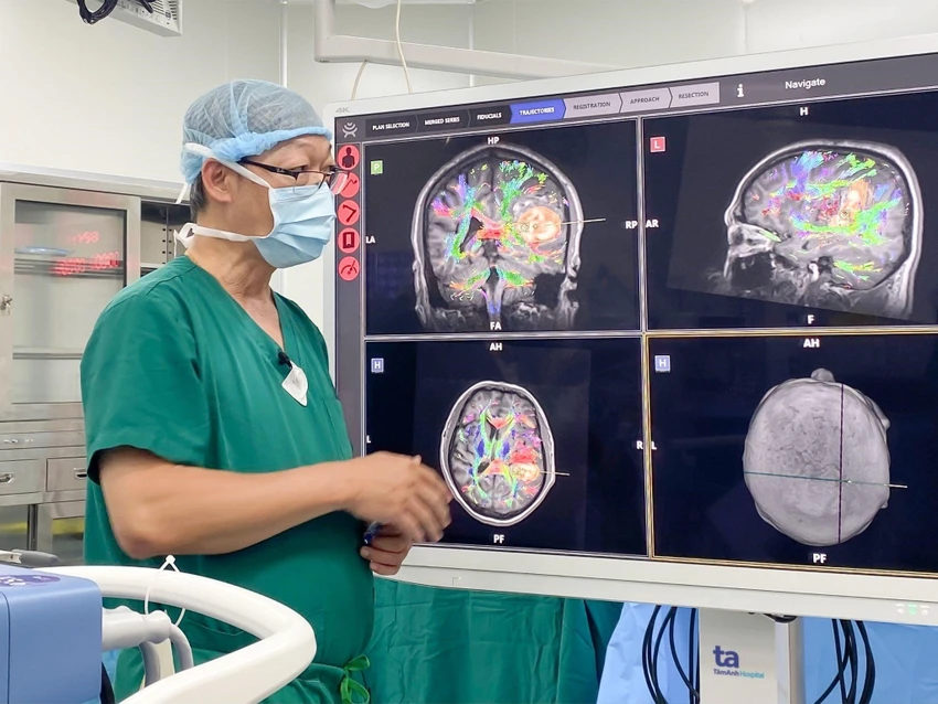 Robot AI hòa hình MRI, DTI… cho thấy rõ các bó sợi thần kinh và khối máu tụ chèn ép trong não người bệnh. Ảnh: NGUYỄN TRĂM