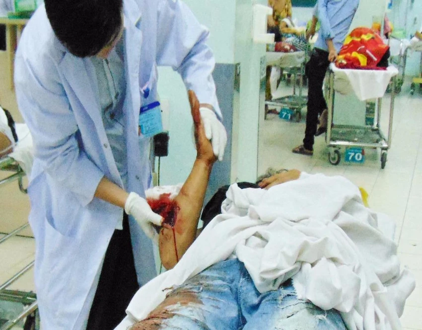 Gãy tay gãy chân chỉ vì... áo khoác không cài dây khóa ảnh 1 tay bị gẫy