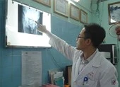Chân bỗng ngắn đi 2cm do trật khớp háng lâu năm