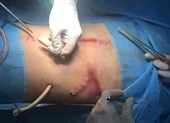 Kích hoạt báo động đỏ cứu thanh niên vỡ nhiều tạng nguy kịch