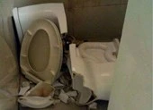 Mông bị cắt sâu do ngồi xổm làm sập bồn cầu