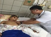 Cha mẹ đắp lá, đậu lào chữa rắn cắn khiến con nguy kịch