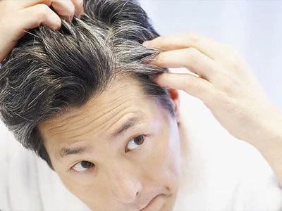Uống hà thủ ô chữa bạc tóc? ảnh 1