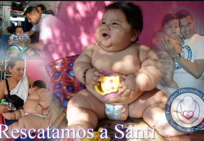 Bé trai béo nhất Colombia được điều trị giảm cân ảnh 1