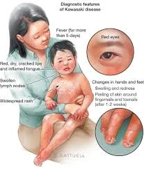 Gió độc từ Trung Quốc - Thủ phạm gây bệnh ở nhiều nước?