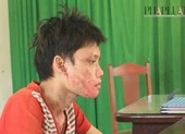 Tạt acid vào bạn gái sau khi đọc được tin nhắn 