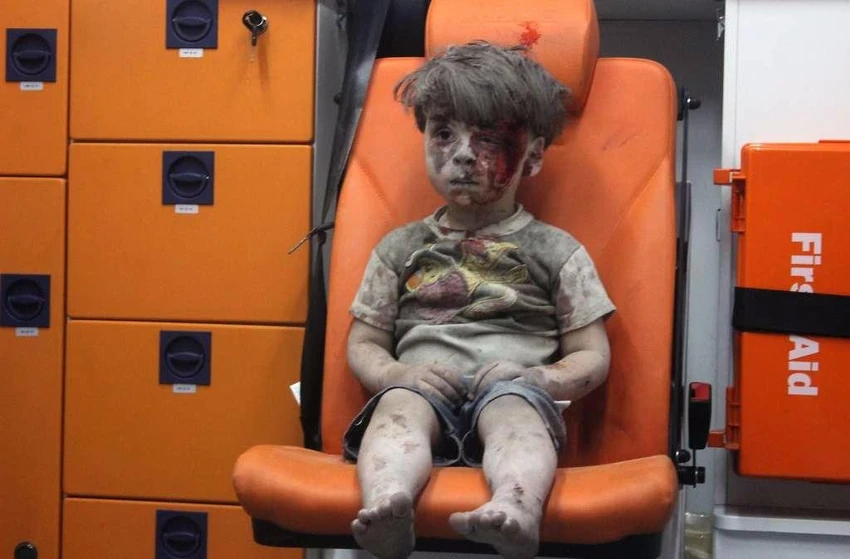 Cậu bé Syria 5 tuổi Omran Daqneesha người đầy máu và bụi, ngồi yên lặng trên trực thăng đi cấp cứu. 