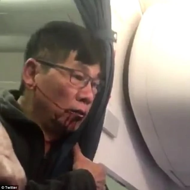 Ông Dao chảy máu trên mặt trong khi xô xát với trên máy bay. Ảnh: DAILY MAIL