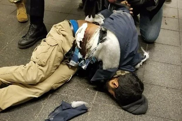 Nghi can Ullah bị thương sau vụ nổ. Ảnh: CBS NEWS