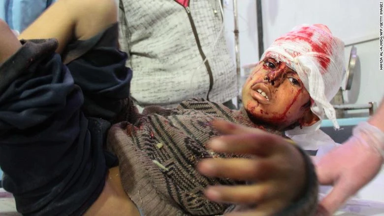 Trong số nạn nhân ở Đông Ghouta có rất nhiều trẻ em. Ảnh: CNN